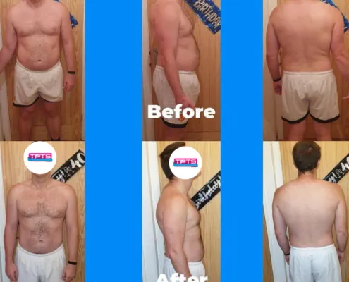 before and after